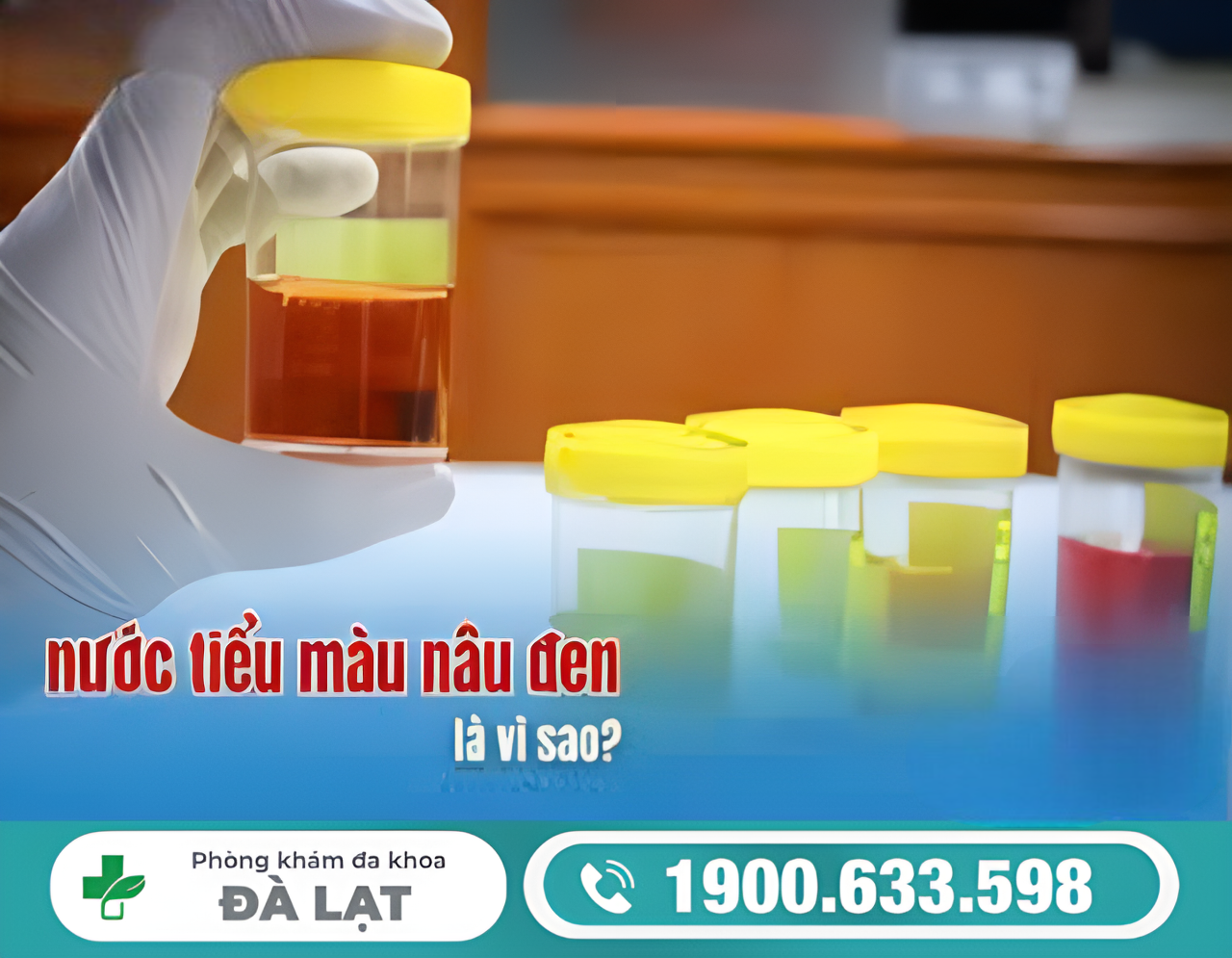 Hình ảnh minh họa